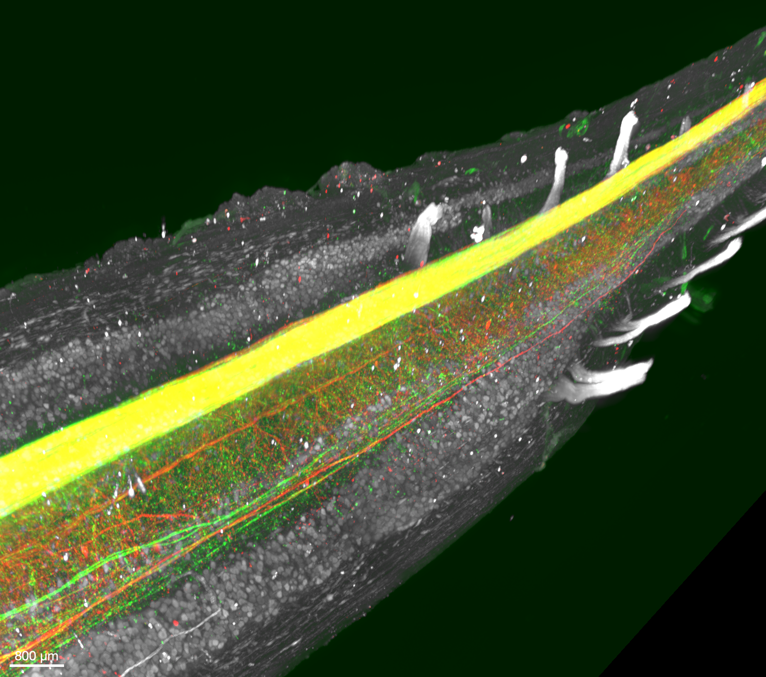 Corticospinal Expansion